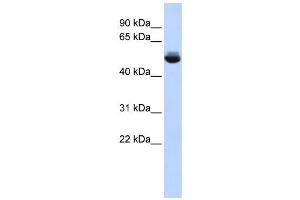 Western Blotting (WB) image for anti-Translocation Associated Membrane Protein 1-Like 1 (TRAM1L1) antibody (ABIN2459605)