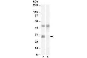 Western blot testing of human breast cancer lysate with IGFBP3 antibody at 0. (IGFBP3 anticorps)