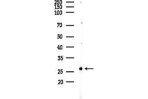 Western blot analysis of lysates from F10-LUC cells(heat-shock 45 min treatment), using ZNF575 Antibody at 1/1000 dilution.