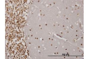 Immunoperoxidase of monoclonal antibody to EN1 on formalin-fixed paraffin-embedded human cerebellum. (EN1 anticorps  (AA 266-392))