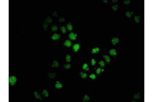 Immunofluorescence staining of Hela cells with ABIN7149505 at 1:200, counter-stained with DAPI. (APPL2 anticorps  (AA 399-512))