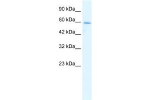 WB Suggested Anti-HCLS1 Antibody Titration:  1. (HCLS1 anticorps  (N-Term))