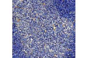 IHC analysis of CD31 using anti-CD31 antibody (ABIN5692990).