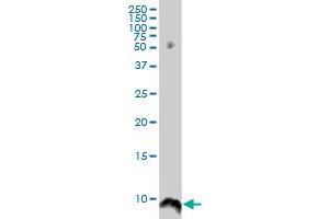 ATOX1 monoclonal antibody (M05), clone 3E1.