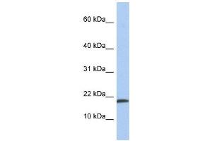 IL1 alpha antibody used at 1 ug/ml to detect target protein.