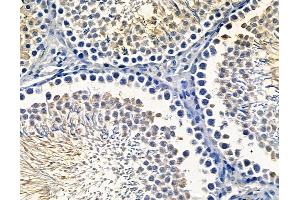 ABIN7096741 and ABIN7100806 at 1/100 staining rat testis tissue by IHC-P. (MGAT2 anticorps)