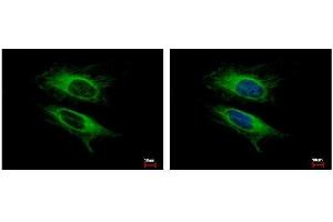 ICC/IF Image VPS11 antibody detects VPS11 protein at cytoplasm by immunofluorescent analysis. (VPS11 anticorps  (Center))