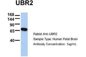 Host:  Rabbit  Target Name:  UBR2  Sample Type:  Human Fetal Brain  Antibody Dilution:  1. (UBR2 anticorps  (C-Term))