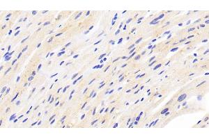 Detection of FNDC5 in Human Cardiac Muscle Tissue using Polyclonal Antibody to Fibronectin Type III Domain Containing Protein 5 (FNDC5)
