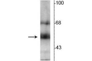 Western blot of hippocampal lysate showing specific immunolabeling of the ~55 kDa TR-β protein. (THRB anticorps  (N-Term))