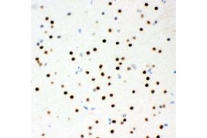 Anti- MSK1 Picoband antibody, IHC(P) IHC(P): Rat Brain Tissue