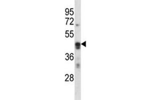 ARC antibody western blot analysis in K562 lysate. (ARC (AA 37-66) anticorps)