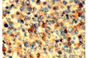 Immunohistochemistry (IHC) image for anti-Abl-Interactor 1 (ABI1) antibody (ABIN1449186)