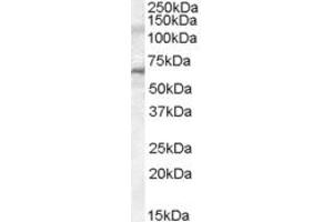 Western Blotting (WB) image for anti-Interleukin-1 Receptor-Associated Kinase 3 (IRAK3) (AA 582-593) antibody (ABIN296287) (IRAK3 anticorps  (AA 582-593))