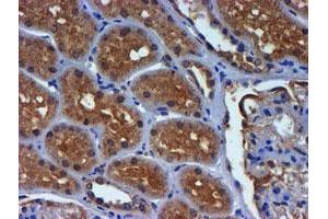 Immunohistochemical staining of paraffin-embedded Human Kidney tissue using anti-PDSS2 mouse monoclonal antibody. (PDSS2 anticorps)