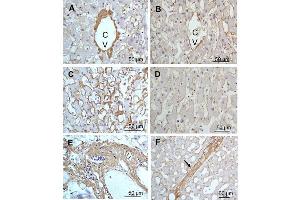 Immunohistochemistry of Rabbit Anti-collagen type III antibody.