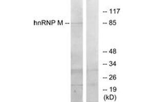 Western Blotting (WB) image for anti-Heterogeneous Nuclear Ribonucleoprotein M (HNRNPM) (AA 11-60) antibody (ABIN2889505) (HNRNPM anticorps  (AA 11-60))