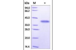 Human Arginase 1, His Tag on SDS-PAGE under reducing (R) condition.