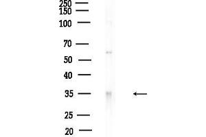 Western blot analysis of lysates from F10-LUC cells(heat-shock,45 min treatment), using Phospho- (Ser219) Antibody at 1/1000 dilution.