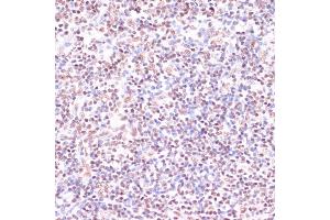 Immunohistochemistry of paraffin-embedded mouse brain using CREB1 antibody (ABIN7266053) at dilution of 1:100 (40x lens).