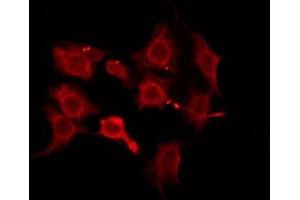 ABIN6276176 staining HeLa by IF/ICC. (OR5W2 anticorps  (Internal Region))