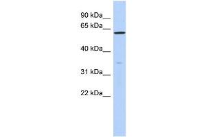 WB Suggested Anti-ZNF431 Antibody Titration:  0. (ZNF431 anticorps  (N-Term))