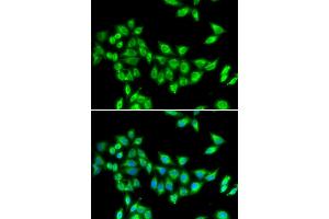 Immunofluorescence analysis of U2OS cells using KIF3A antibody (ABIN5973995). (KIF3A anticorps)