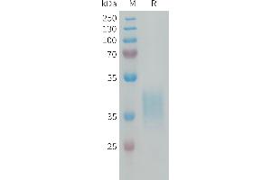 Human C Protein, His Tag on SDS-PAGE under reducing condition.