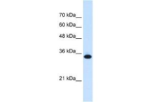 WB Suggested Anti-SLC25A38 Antibody Titration:  0. (SLC25A38 anticorps  (Middle Region))