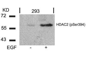 Western blot analysis of extracts from 293 cells untreated or treated with EGF using HDAC2(Phospho-Ser394) Antibody. (HDAC2 anticorps  (pSer394))