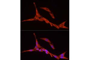 Immunofluorescence analysis of PC-12 cells using RPS18 Rabbit pAb (ABIN6128660, ABIN6147205, ABIN6147206 and ABIN6215379) at dilution of 1:250 (40x lens).