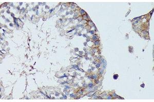 Immunohistochemistry of paraffin-embedded Mouse testis using SLC7A2 Polyclonal Antibody at dilution of 1:100 (40x lens). (SLC7A2 anticorps)