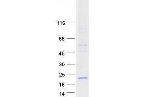 Validation with Western Blot