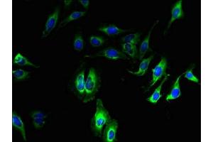 Immunofluorescent analysis of Hela cells using ABIN7148847 at dilution of 1:100 and Alexa Fluor 488-congugated AffiniPure Goat Anti-Rabbit IgG(H+L)