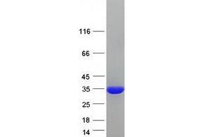 Validation with Western Blot