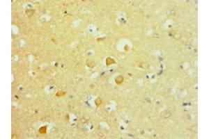 Immunohistochemistry of paraffin-embedded human brain tissue using ABIN7144051 at dilution of 1:100