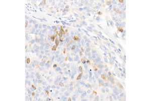 Immunohistochemistry of paraffin-embedded mouse spleen using cGAS Rabbit pAb (ABIN6134073, ABIN6143590, ABIN6143591 and ABIN6224360) at dilution of 1:50 (40x lens).