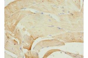 Immunohistochemistry of paraffin-embedded human skeletal muscle tissue using ABIN7163186 at dilution of 1:100 (PIP5K1B anticorps  (AA 190-470))
