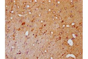 IHC image of ABIN7127722 diluted at 1:100 and staining in paraffin-embedded rat brain tissue performed on a Leica BondTM system.