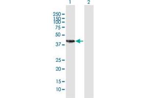 Western Blot analysis of HSD11B2 expression in transfected 293T cell line by HSD11B2 MaxPab polyclonal antibody. (HSD11B2 anticorps  (AA 1-405))