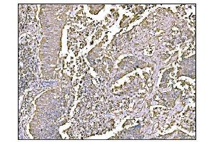 IHC analysis of HCCS using anti-HCCS antibody (ABIN7602424). (HCCS anticorps  (AA 76-268))