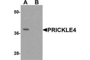 Western blot analysis of PRICKLE4 in A549 cell lysate with PRICKLE4 Antibody  at 0. (PRICKLE4 anticorps  (N-Term))