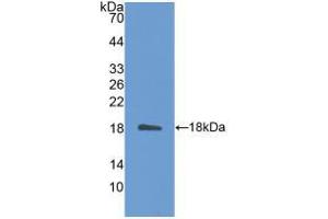 Western blot analysis of recombinant Mouse IL31. (IL-31 anticorps  (AA 28-154))