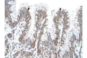 RSRC2 antibody was used for immunohistochemistry at a concentration of 4-8 ug/ml to stain Epithelial cells of fundic gland (arrows) in Human Stomach. (RSRC2 anticorps  (C-Term))
