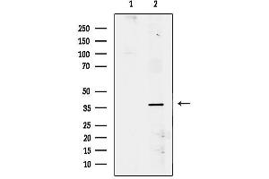 anti-Siah E3 Ubiquitin Protein Ligase 2 (SIAH2) (C-Term) antibody