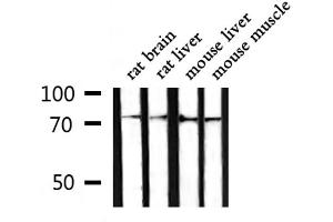 Western blot analysis of extracts from rat brain ,rat liver,mouse liver,mouse muscle, using GARS Antibody.