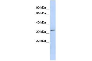 WB Suggested Anti-PDXP Antibody Titration: 0. (PDXP anticorps  (Middle Region))