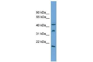 DUSP5 antibody used at 0.