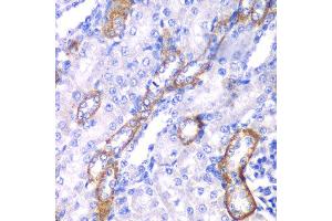 Immunohistochemistry of paraffin-embedded rat kidney using MYO1C antibody at dilution of 1:100 (x40 lens). (Myosin IC anticorps)
