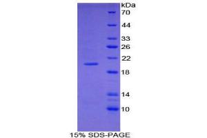 SDS-PAGE (SDS) image for Collagen, Type III, alpha 1 (COL3A1) (AA 434-643) protein (His tag) (ABIN2120857) (COL3A1 Protein (AA 434-643) (His tag))